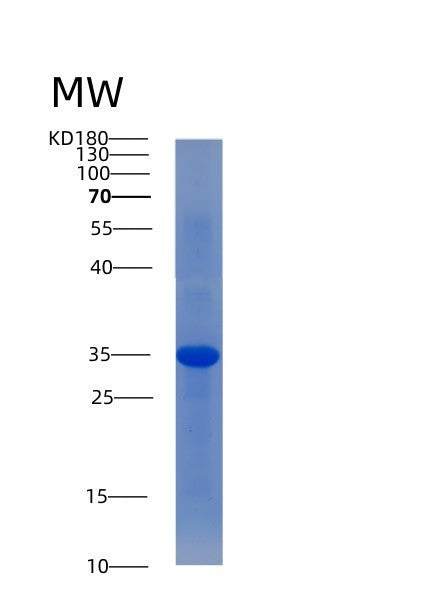 SDS-PAGE analysis of Human ACP5 (Tartrate-Resistant Acid Phosphatase Type 5) - Recombinant Protein, showing >85% purity under 15% SDS-PAGE (Reduced)