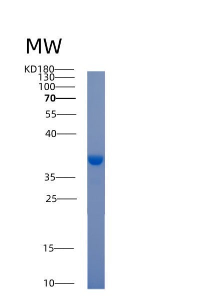 SDS-PAGE analysis of Human ACY3 (N-Acyl-Aromatic-L-Amino Acid Amidohydrolase (Carboxylate-Forming)) - Recombinant Protein, showing >85% purity under 15% SDS-PAGE (Reduced)