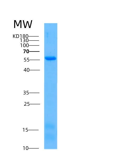 SDS-PAGE analysis of Human AKT1 (Rac-Alpha Serine/Threonine-Protein Kinase) - Recombinant Protein, showing >95% purity under 15% SDS-PAGE (Reduced)
