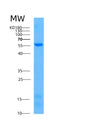 SDS-PAGE analysis of Human AKT1 (Rac-Alpha Serine/Threonine-Protein Kinase) - Recombinant Protein, showing >95% purity under 15% SDS-PAGE (Reduced)
