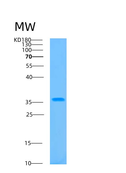 SDS-PAGE analysis of Human B3GAT3 (Galactosylgalactosylxylosylprotein 3-Beta-Glucuronosyltransferase 3) - Recombinant Protein, showing >90% purity under 15% SDS-PAGE (Reduced)