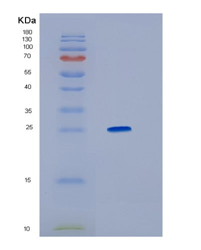 SDS-PAGE analysis of Human HMGB1 (High Mobility Group Protein B1) - Recombinant Protein, showing >90% purity under 15% SDS-PAGE (Reduced)