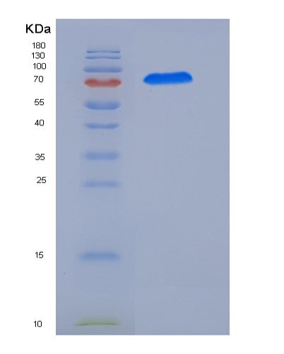 SDS-PAGE analysis of Human CAMKV (Cam Kinase-Like Vesicle-Associated Protein) - Recombinant Protein, showing >90% purity under 15% SDS-PAGE (Reduced)