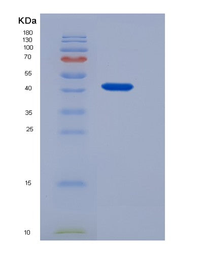 SDS-PAGE analysis of Human ABHD4 ((Lyso)-N-Acylphosphatidylethanolamine Lipase) - Recombinant Protein, showing >90% purity under 15% SDS-PAGE (Reduced)