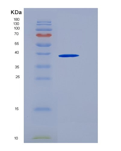 SDS-PAGE analysis of Human ART3 (Ecto-Adp-Ribosyltransferase 3) - Recombinant Protein, showing >90% purity under 15% SDS-PAGE (Reduced)