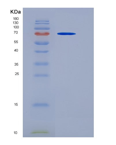 SDS-PAGE analysis of Human PRMT5 (Protein Arginine N-Methyltransferase 5) - Recombinant Protein, showing >90% purity under 15% SDS-PAGE (Reduced)