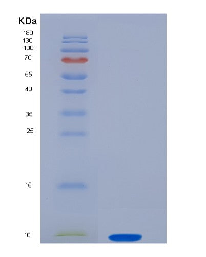 SDS-PAGE analysis of Human SMR3B (Submaxillary Gland Androgen-Regulated Protein 3B) - Recombinant Protein, showing >95% purity under 15% SDS-PAGE (Reduced)