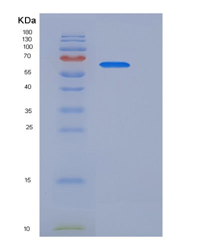 SDS-PAGE analysis of Human WFIKKN2 (Wap, Kazal, Immunoglobulin, Kunitz And Ntr Domain-Containing Protein 2) - Recombinant Protein, showing >90% purity under 15% SDS-PAGE (Reduced)