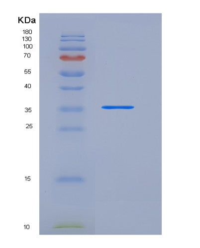 SDS-PAGE analysis of Human CARTPT (Cocaine- And Amphetamine-Regulated Transcript Protein) - Recombinant Protein, showing >90% purity under 15% SDS-PAGE (Reduced)