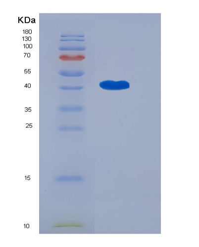 SDS-PAGE analysis of Human OMG (Oligodendrocyte-Myelin Glycoprotein) - Recombinant Protein, showing >95% purity under 15% SDS-PAGE (Reduced)