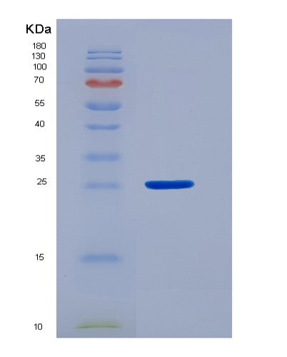 SDS-PAGE analysis of Human C1QBP (Complement Component 1 Q Subcomponent-Binding Protein, Mitochondrial) - Recombinant Protein, showing >90% purity under 15% SDS-PAGE (Reduced)