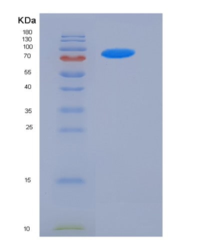 SDS-PAGE analysis of Human FSTL5 (Follistatin-Related Protein 5) - Recombinant Protein, showing >90% purity under 15% SDS-PAGE (Reduced)