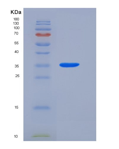 SDS-PAGE analysis of Human LRG1 (Leucine-Rich Alpha-2-Glycoprotein) - Recombinant Protein, showing >95% purity under 15% SDS-PAGE (Reduced)