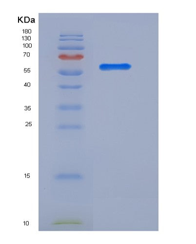 SDS-PAGE analysis of Human LRG1 (Leucine-Rich Alpha-2-Glycoprotein) - Recombinant Protein, showing >85% purity under 15% SDS-PAGE (Reduced)