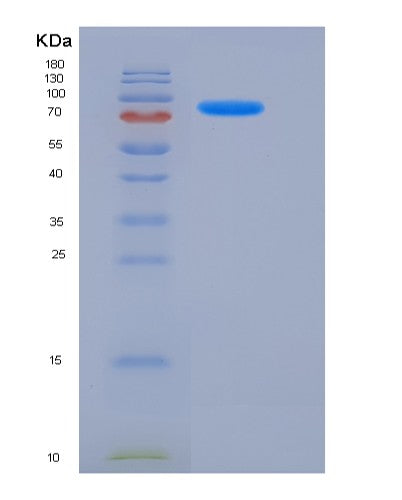 SDS-PAGE analysis of Human PDE1B (Dual Specificity Calcium/Calmodulin-Dependent 3',5'-Cyclic Nucleotide Phosphodiesterase 1B) - Recombinant Protein, showing >85% purity under 15% SDS-PAGE (Reduced)