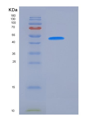SDS-PAGE analysis of Human VNN2 (Pantetheine Hydrolase Vnn2) - Recombinant Protein, showing >95% purity under 15% SDS-PAGE (Reduced)