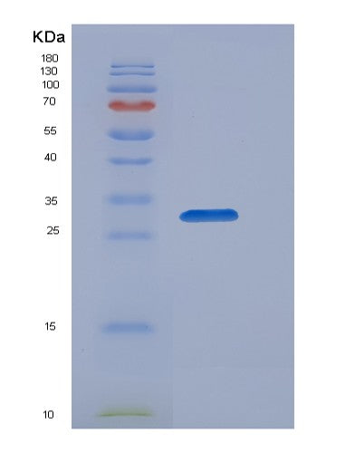 SDS-PAGE analysis of Human OSTM1 (Osteopetrosis-Associated Transmembrane Protein 1) - Recombinant Protein, showing >85% purity under 15% SDS-PAGE (Reduced)