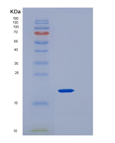 SDS-PAGE analysis of Human CD4 (T-Cell Surface Glycoprotein Cd4) - Recombinant Protein, showing >95% purity under 15% SDS-PAGE (Reduced)