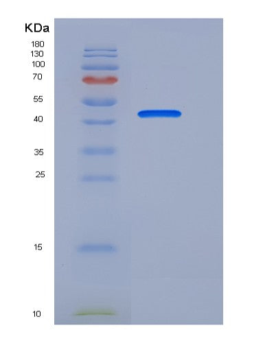 SDS-PAGE analysis of Human ENPP7 (Ectonucleotide Pyrophosphatase/Phosphodiesterase Family Member 7) - Recombinant Protein, showing >90% purity under 15% SDS-PAGE (Reduced)