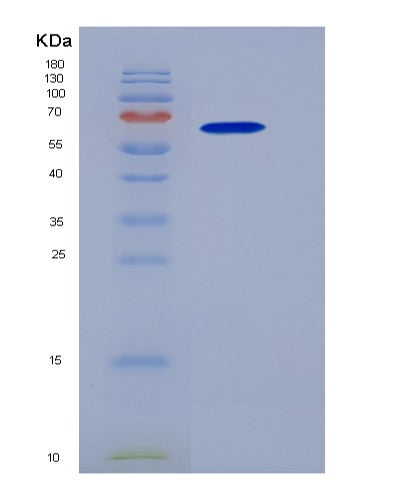 SDS-PAGE analysis of Human IL1RAPL2 (X-Linked Interleukin-1 Receptor Accessory Protein-Like 2) - Recombinant Protein, showing >95% purity under 15% SDS-PAGE (Reduced)