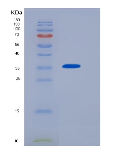 SDS-PAGE analysis of Human NMNAT2 (Nicotinamide/Nicotinic Acid Mononucleotide Adenylyltransferase 2) - Recombinant Protein, showing >85% purity under 15% SDS-PAGE (Reduced)