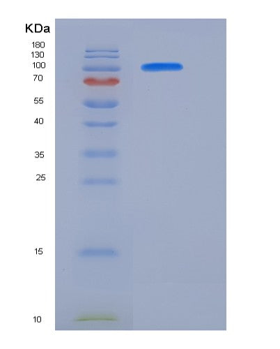 SDS-PAGE analysis of Human STAT1 (Signal Transducer And Activator Of Transcription 1-Alpha/Beta) - Recombinant Protein, showing >85% purity under 15% SDS-PAGE (Reduced)