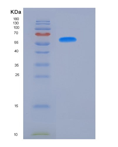 SDS-PAGE analysis of Human FUT8 (Alpha-(1,6)-Fucosyltransferase) - Recombinant Protein, showing >90% purity under 15% SDS-PAGE (Reduced)