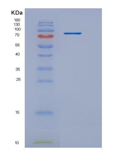 SDS-PAGE analysis of Mouse Osmr (Oncostatin-M-Specific Receptor Subunit Beta) - Recombinant Protein, showing >90% purity under 15% SDS-PAGE (Reduced)