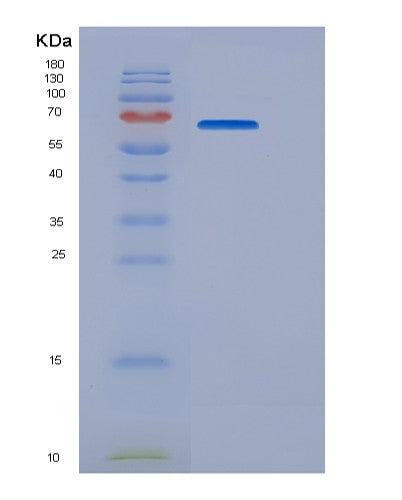 SDS-PAGE analysis of Mouse Creld1 (Protein Disulfide Isomerase Creld1) - Recombinant Protein, showing >95% purity under 15% SDS-PAGE (Reduced)