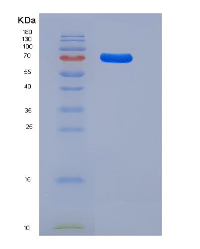 SDS-PAGE analysis of Human NTRK3 (Nt-3 Growth Factor Receptor) - Recombinant Protein, showing >85% purity under 15% SDS-PAGE (Reduced)