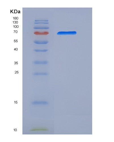 SDS-PAGE analysis of Mouse Erbb4 (Receptor Tyrosine-Protein Kinase Erbb-4) - Recombinant Protein, showing >90% purity under 15% SDS-PAGE (Reduced)