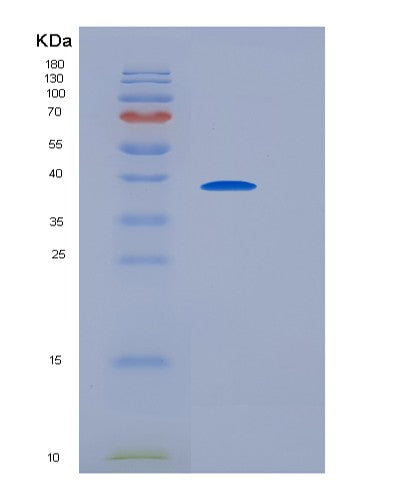 SDS-PAGE analysis of Mouse Lair1 (Leukocyte-Associated Immunoglobulin-Like Receptor 1) - Recombinant Protein, showing >85% purity under 15% SDS-PAGE (Reduced)
