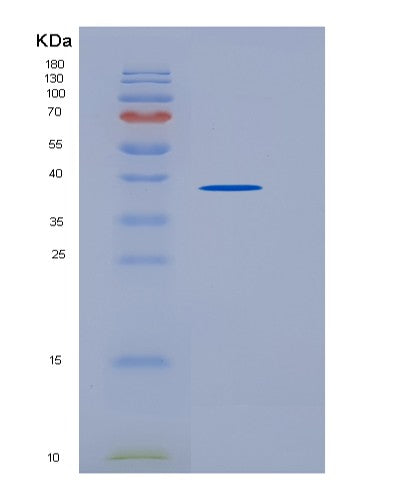 SDS-PAGE analysis of Mouse Agrp (Agouti-Related Protein) - Recombinant Protein, showing >95% purity under 15% SDS-PAGE (Reduced)