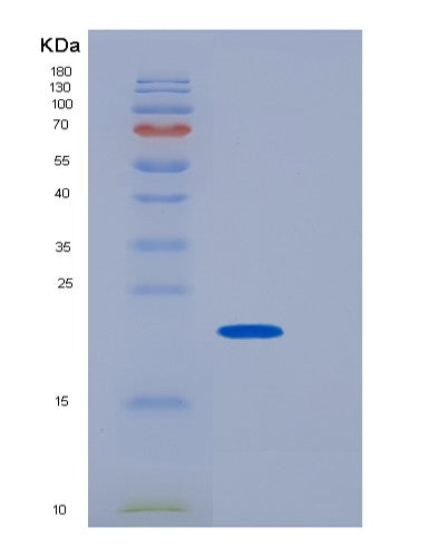 SDS-PAGE analysis of Human RNF43 (E3 Ubiquitin-Protein Ligase Rnf43) - Recombinant Protein, showing >85% purity under 15% SDS-PAGE (Reduced)