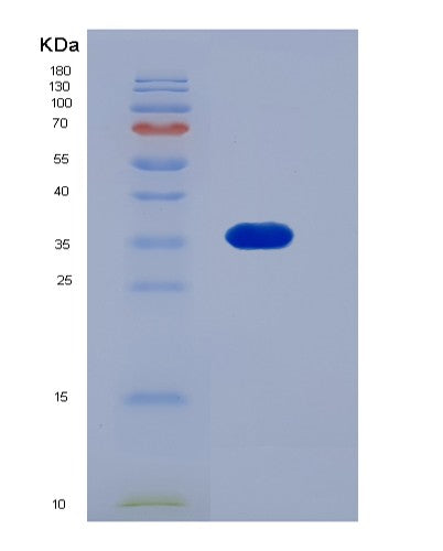 SDS-PAGE analysis of Mouse Il13ra1 (Interleukin-13 Receptor Subunit Alpha-1) - Recombinant Protein, showing >90% purity under 15% SDS-PAGE (Reduced)