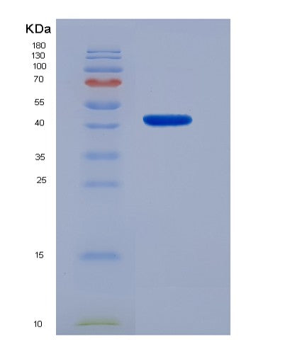 SDS-PAGE analysis of Mouse Fcgrt (Igg Receptor Fcrn Large Subunit P51) - Recombinant Protein, CAT# BLT-08435P showing >85% purity under 15% SDS-PAGE (Reduced)