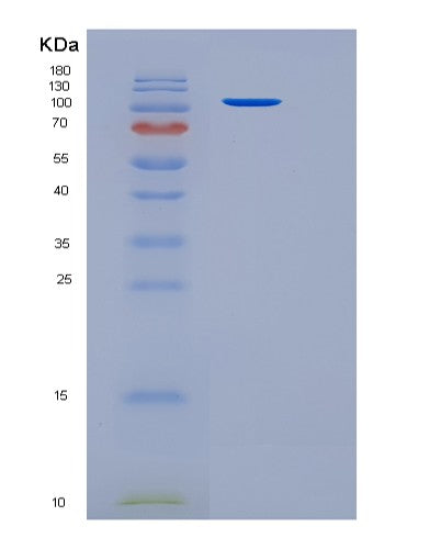 SDS-PAGE analysis of Human SORCS1 (Vps10 Domain-Containing Receptor Sorcs1) - Recombinant Protein, showing >90% purity under 15% SDS-PAGE (Reduced)