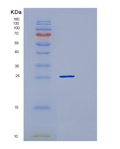 SDS-PAGE analysis of Human HMGB1 (High Mobility Group Protein B1) - Recombinant Protein, showing >95% purity under 15% SDS-PAGE (Reduced)