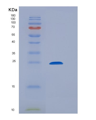 SDS-PAGE analysis of Human C1QBP (Complement Component 1 Q Subcomponent-Binding Protein, Mitochondrial) - Recombinant Protein, showing >95% purity under 15% SDS-PAGE (Reduced)