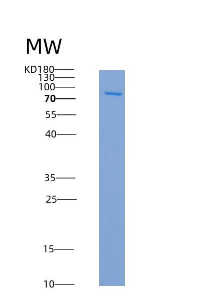 SDS-PAGE analysis of Human GRK6 (G Protein-Coupled Receptor Kinase 6) - Recombinant Protein, showing >90% purity under 15% SDS-PAGE (Reduced)