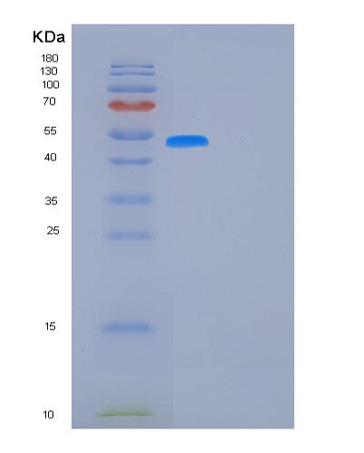 SDS-PAGE analysis of Human FUCA1 (Tissue Alpha-L-Fucosidase) - Recombinant Protein, showing >95% purity under 15% SDS-PAGE (Reduced)