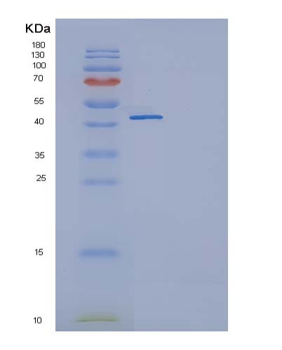 SDS-PAGE analysis of Human TNFRSF19 (Tumor Necrosis Factor Receptor Superfamily Member 19) - Recombinant Protein, showing >95% purity under 15% SDS-PAGE (Reduced)