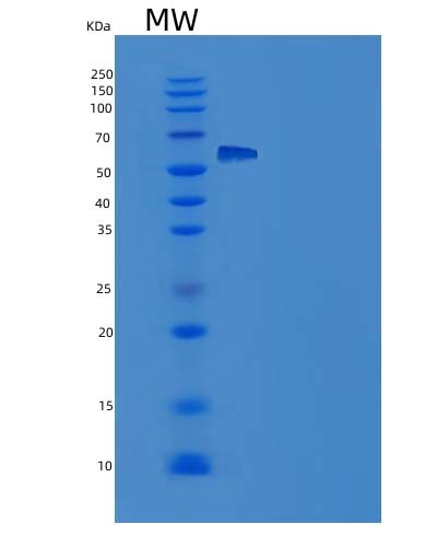 SDS-PAGE analysis of Human AMY2A (Pancreatic Alpha-Amylase) - Recombinant Protein, CAT# BLT-08415P showing >85% purity under 15% SDS-PAGE (Reduced)