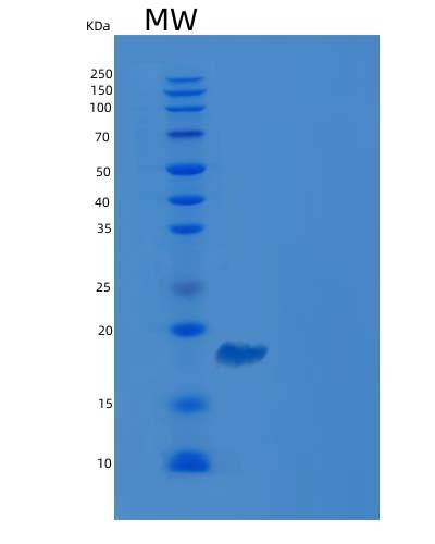 SDS-PAGE analysis of Human CDC42BPB (Serine/Threonine-Protein Kinase Mrck Beta) - Recombinant Protein, showing >90% purity under 15% SDS-PAGE (Reduced)