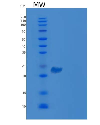 SDS-PAGE analysis of Human VSIG2 (V-Set And Immunoglobulin Domain-Containing Protein 2) - Recombinant Protein, showing >85% purity under 15% SDS-PAGE (Reduced)