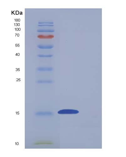 SDS-PAGE analysis of Mouse Cd7 (T-Cell Antigen Cd7) - Recombinant Protein, showing >95% purity under 15% SDS-PAGE (Reduced)