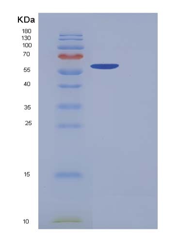 SDS-PAGE analysis of Human CDK5 (Cyclin-Dependent Kinase 5) - Recombinant Protein, showing >90% purity under 15% SDS-PAGE (Reduced)