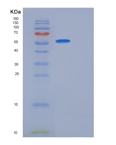 SDS-PAGE analysis of Human DPAGT1 (Udp-N-Acetylglucosamine--Dolichyl-Phosphate N-Acetylglucosaminephosphotransferase) - Recombinant Protein, showing >90% purity under 15% SDS-PAGE (Reduced)