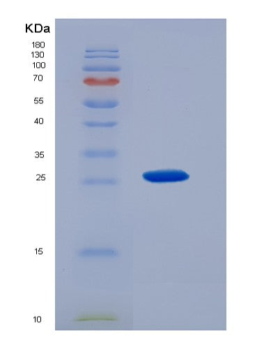 SDS-PAGE analysis of Human SIGMAR1 (Sigma Non-Opioid Intracellular Receptor 1) - Recombinant Protein, showing >95% purity under 15% SDS-PAGE (Reduced)