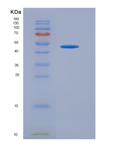 SDS-PAGE analysis of Human HMGB1 (High Mobility Group Protein B1) - Recombinant Protein, showing >95% purity under 15% SDS-PAGE (Reduced)